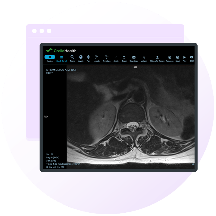 image showcasing dashboard to upload high-quality radiology images on crelio pacs cloud storage on secure server