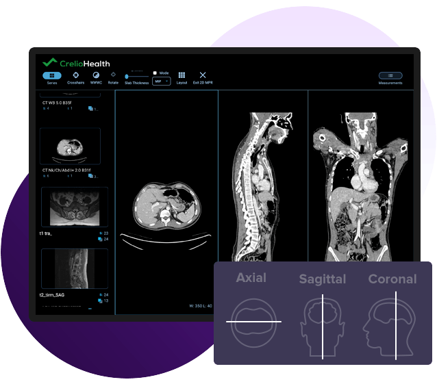 crelio pacs software system dashboard showcasing image manipulation capabilities with advanced multi-view display using ohif-based pacs viewer