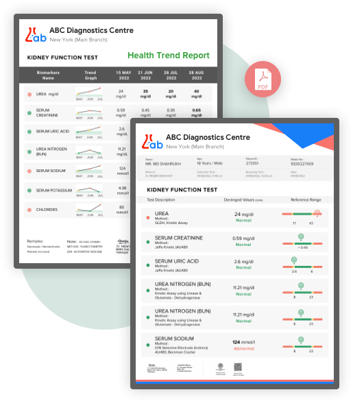 image showcasing a report sample that demonstrates the enhanced readability and interpretability achieved with smarter blood chemistry reporting features