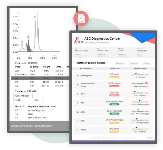 image displaying smart reports and trends reports that are extremely easy to read and interpret hematology test results for any patient