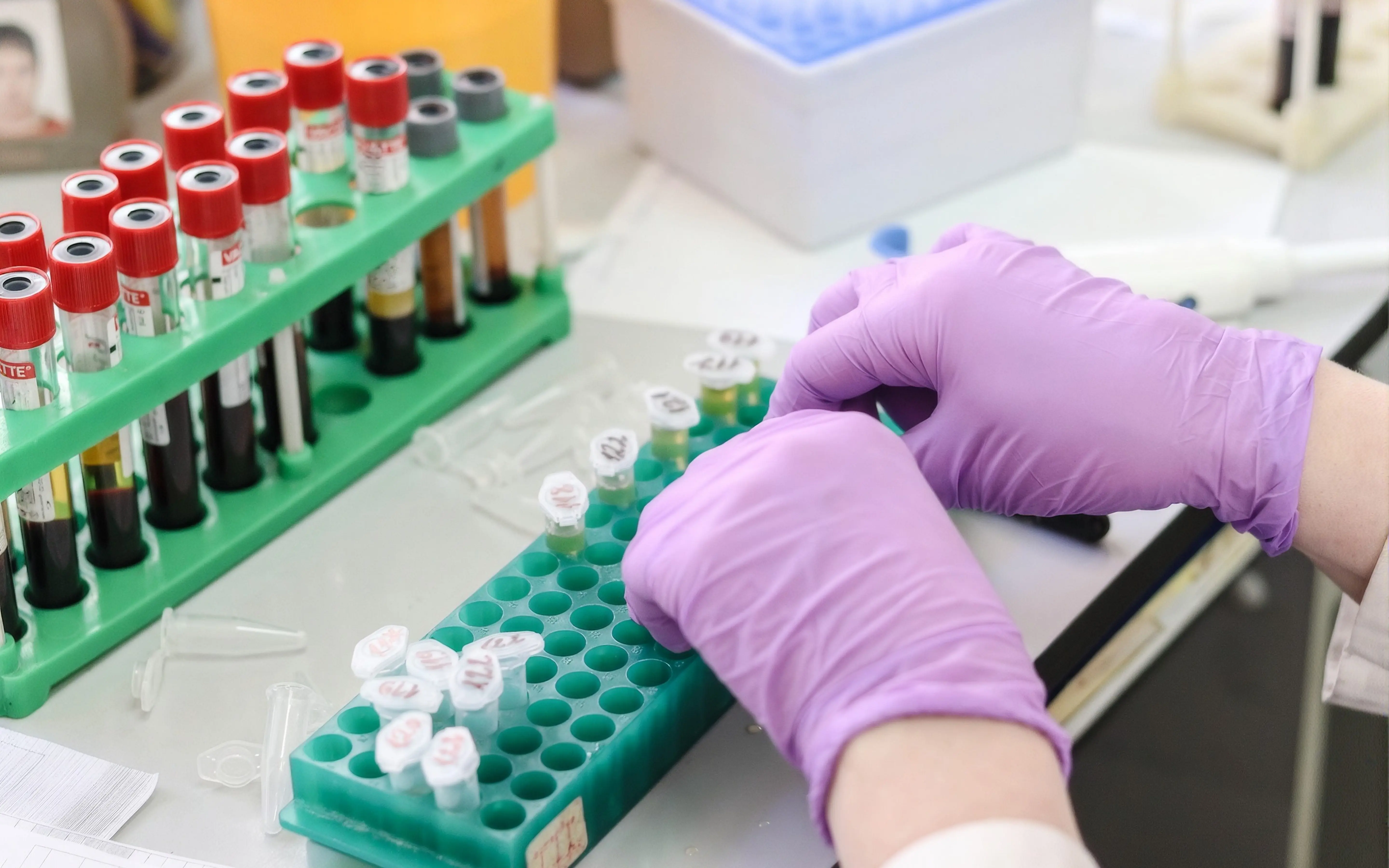 Image illustrating a lab technician using CrelioHealth’s user-friendly, cost-effective LIMS to improve productivity, maximize ROI, and reduce operational costs