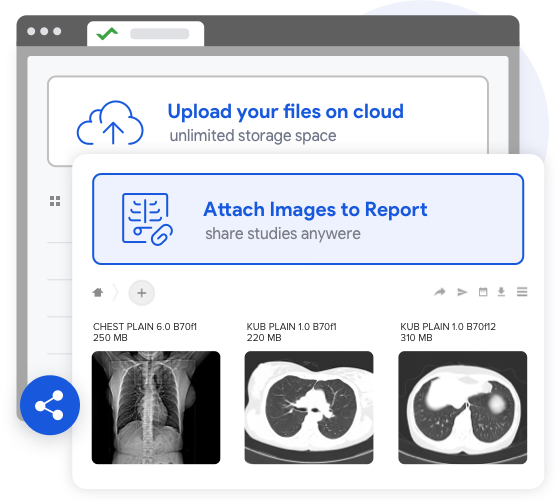 radiology workflow integrated with PACS offers a reporting software dashboard that allows lossless compression of radiology scan images & studies to upload it on cloud or attach it to radiology reports