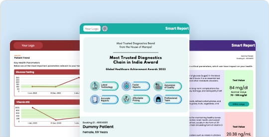 download smart report